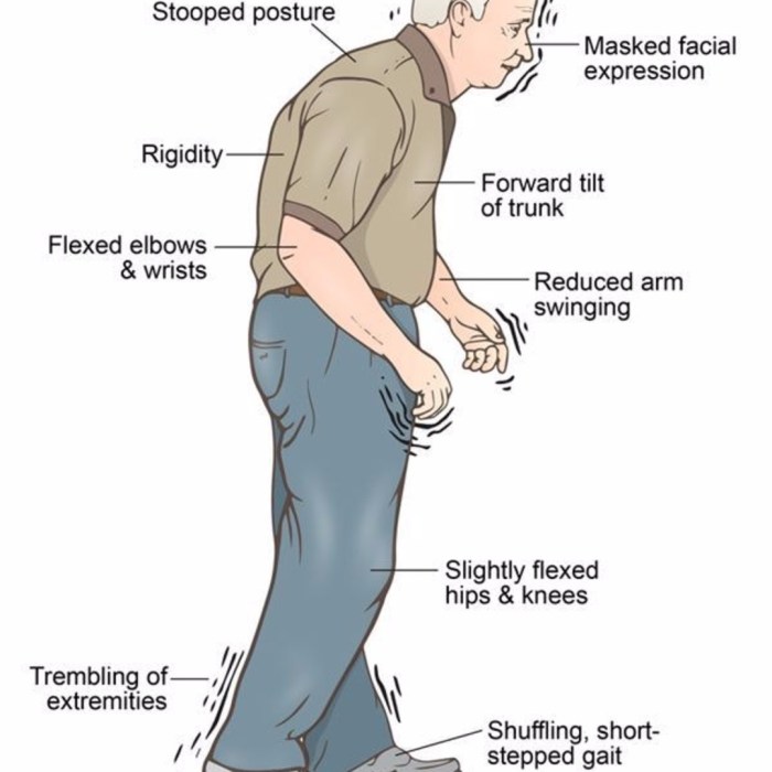 Living With Parkinson's Disease A Guide for Kids and Teens